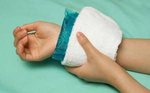 Перелом кисти руки: симптомы, лечение, сколько дней гипс
