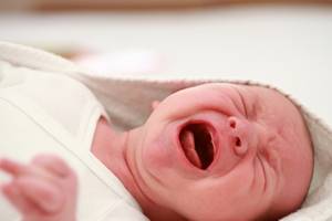 Перелом ключицы у новорожденного при родах