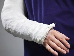 Перелом руки: признаки, симптомы, лечение