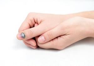 Ушиб ногтя на руке и ноге: что делать в домашних условиях
