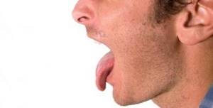 Ожог языка: что делать, как лечить