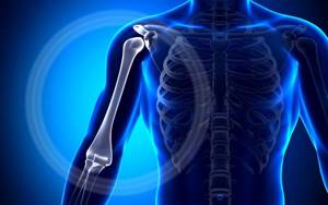 Перелом плечевой кости руки: лечение, срок срастания, операция с пластиной, реабилитация
