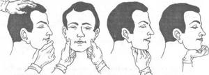 Перелом верхней челюсти: симптомы, лечение