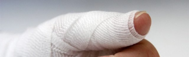 Ушиб пальца на руке: что делать в домашних условиях