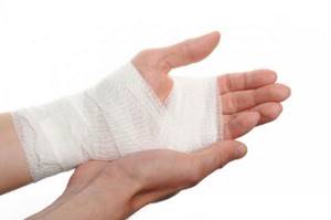 Ушиб кисти руки при падении и ударе: лечение, симптомы