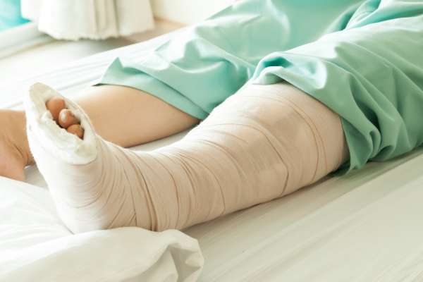 Перелом коленного сустава: симптомы, лечение, реабилитация