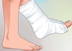Перелом пальца на ноге: что делать, как быстро вылечить