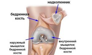 Перелом надколенника (коленной чашечки): лечение, последствия, реабилитация