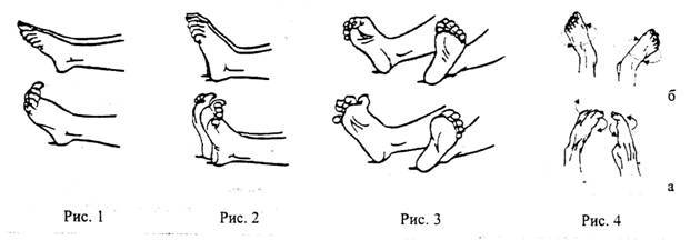 Перелом пальца на ноге: что делать, как быстро вылечить