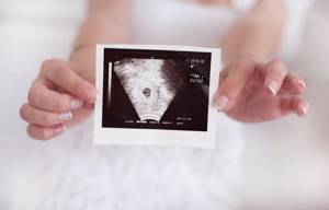 Скрининг первого триместра беременности - результаты, норма, патология