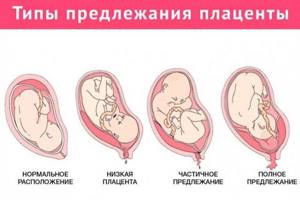 УЗИ при беременности по неделям на разных сроках
