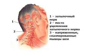 Боль в голове в затылочной части: что делать, причины пульсирующей, сильной боли в затылке, висках, отдающей в шею