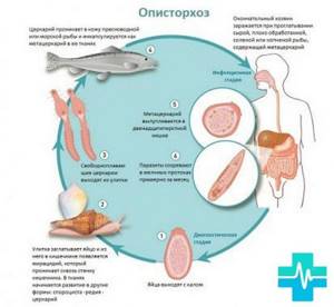 Описторхоз: лечение, в какой рыбе, признаки заражения, симптомы у детей, взрослых