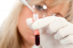 Как передается сифилис, анализы крови на сифилис