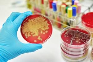 Бактериофаги: что это, лечение, список препаратов, преимущества перед антибиотиками