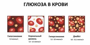 Биохимический анализ крови: норма, расшифровка, причины отклонения результатов