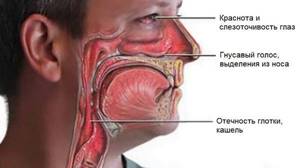 Что делать если першит горло: причины, лечение если кашель, болит горло, заложен нос