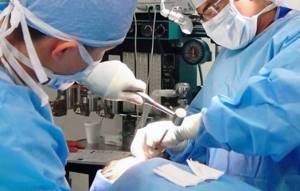 Удаление полипов в носу: все возможные методы оперативного лечения