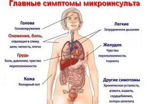 Микроинсульт- признаки, симптомы, лечение, последствия