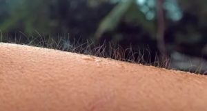 Мурашки по телу, коже: почему бегут мурашки, когда это норма, когда патология