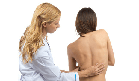 Сколиоз грудного отдела позвоночника: степени, лечение