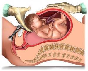 Асфиксия плода при родах: причины и последствия для новорожденных