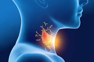 Симптомы и диагностика заболеваний щитовидной железы