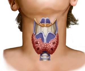 Гипоплазия щитовидной железы: причины, симптомы, лечение