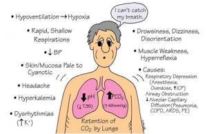 Метаболический ацидоз: симптомы, лечение, причины