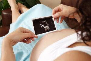 Резус конфликт при беременности: что это, чем опасен при второй и первой беременности