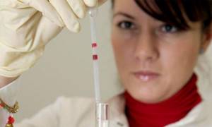 Анализ крови на ревмопробы: расшифровка, норма, как сдавать, результат ревматоидного фактора