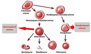 Признаки рака крови