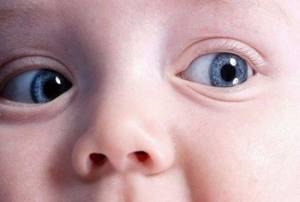 Расширенные зрачки: причины постоянно расширенных зрачков у ребенка