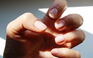Заусенцы на пальцах рук: причины, как убрать, лечение частых надрывов кожи вокруг ногтя