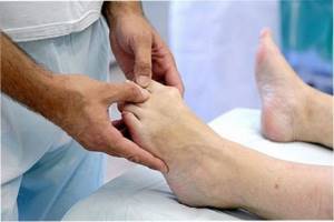 Перелом пальца на ноге: симптомы, признаки, лечение