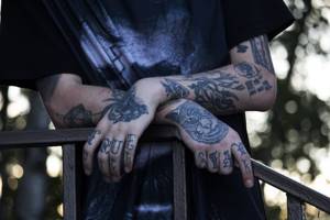 Провокатором рака кожи может служить удаление татуировок