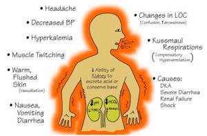 Метаболический ацидоз: симптомы, лечение, причины