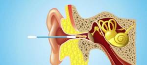 Боль в ушах: причины, что делать, как лечить