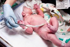 Родовая травма новорожденных: последствия, причины