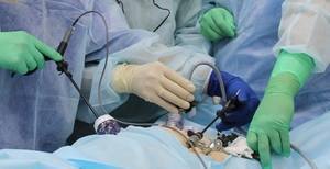 При эндоскопических операциях пальпацию будут выполнять с помощью капсулы