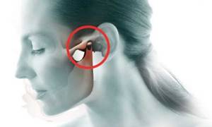 Боль в челюсти: причины, если болит при жевании, в верхней, нижней челюсти, отдает в ухо