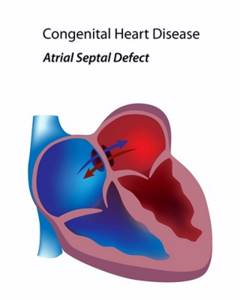 Врожденный порок сердца: признаки у новорожденных, последствия, диагностика, причины и группы риска