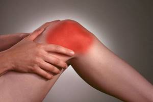 Почему возникает бурсит коленного сустава, какие симптомы и как его лечить