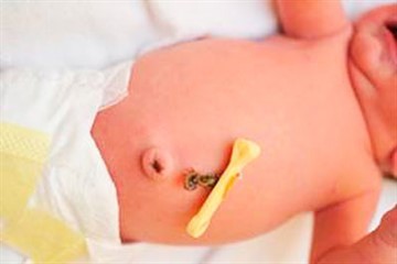 Пупок новорожденного: как обрабатывать, что делать если он гноится или кровит