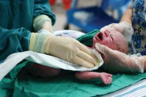 Родовая травма новорожденных: последствия, причины