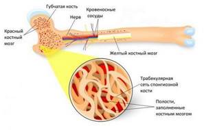 Остеосклероз: причины, лечение, костей, суставов, тел позвонков