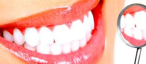 Отбеливание зубов: в домашних условиях, методы в стоматологии без вреда для здоровья